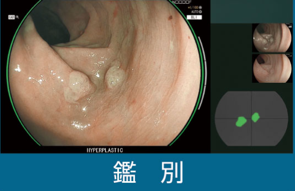 鑑別